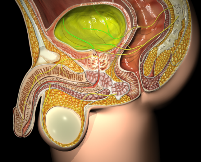 Benign prostatic hyperplasia (BPH)